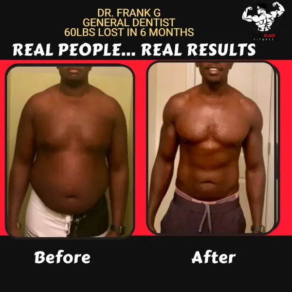 Dr. Frank G. before and after