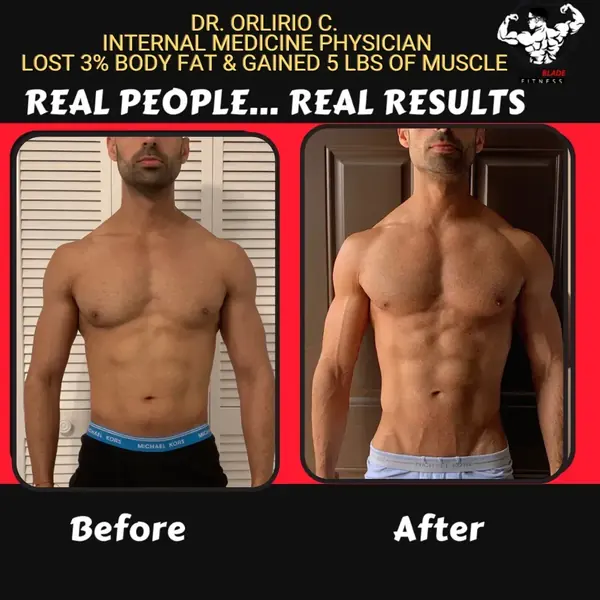 Dr. Orlirio C. before and after